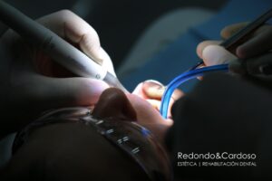 Prótesis Dentales Poniendo